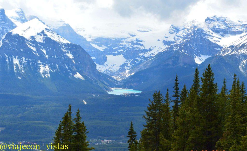 vistas maravillosas de lake louise